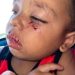 Menino de 1 ano é mordido por cachorro em restaurante de Vila Velha Menino de 1 ano é mordido por cachorro em restaurante de Vila Velha